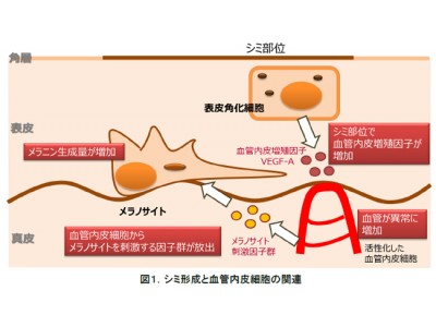 異常な毛細血管ネットワークがシミ形成に関与することを発見　― シミへの新しいアプローチが可能に ―