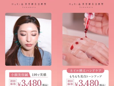 熊本の夏を彩る【第48回火の国まつり】で最新美容体験！美容鍼灸治療院『HaRi&‐ハリト‐』が2日間限定出店