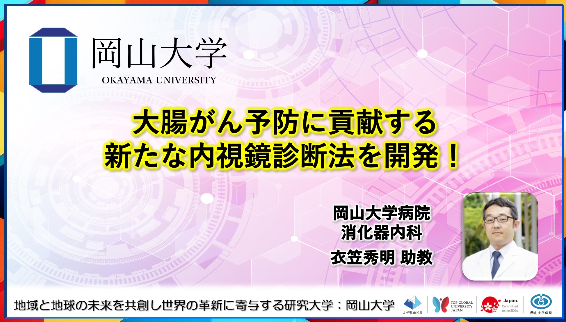 【岡山大学】大腸がん予防に貢献する新たな内視鏡診断法を開発！