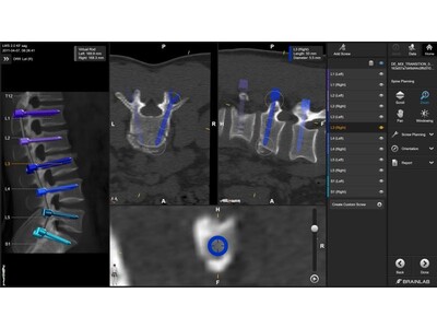ブレインラボが「第52回日本脊椎脊髄病学会学術集会」に出展、脊椎外科デジタル手術用製品ポートフォリオを展示いたします
