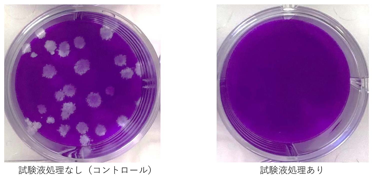 株式会社リジュベネーションシステム社製トリートメントジェルの新型コロナウイルス（SARS-CoV-2）の不活化を奈良県立医科大学で実証されました。
