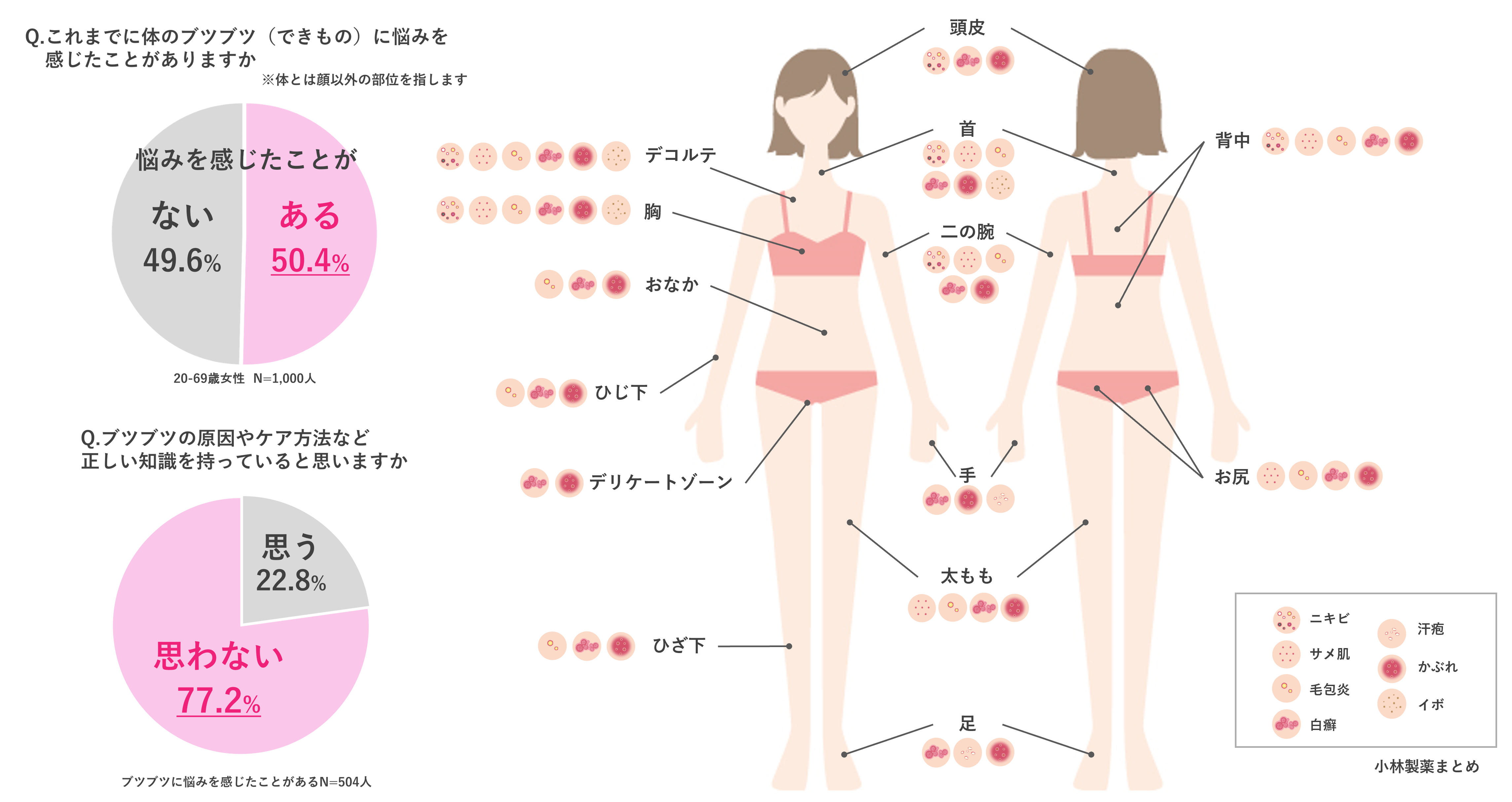 それってニキビじゃないかも？“ からだの部位 ”や“ ブツブツの種類 ”ごとに正しいケアへと導く、皮膚科医監修「からだのブツブツまるわかりMAP」を公開！