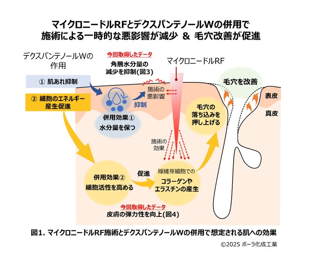デクスパンテノールWは美容医療施術の複合ケアで角層水分量と皮膚の弾力性に寄与することを確認