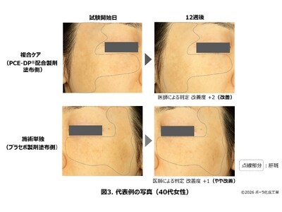 ���[�U�[�g�[�j���O�{�p��PCE�]DP(R)�i�s�[�X �f�B�[�s�[�j�z�����܂̕����P�A�̈��S���ƗL�������N���j�b�N�Ƌ����Ŏ���