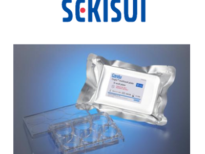 �I���K�m�C�h�|�{�����̐[���Ɍ����ăj�R���Ƌ����Łu����^���������v�̕�W���J�n