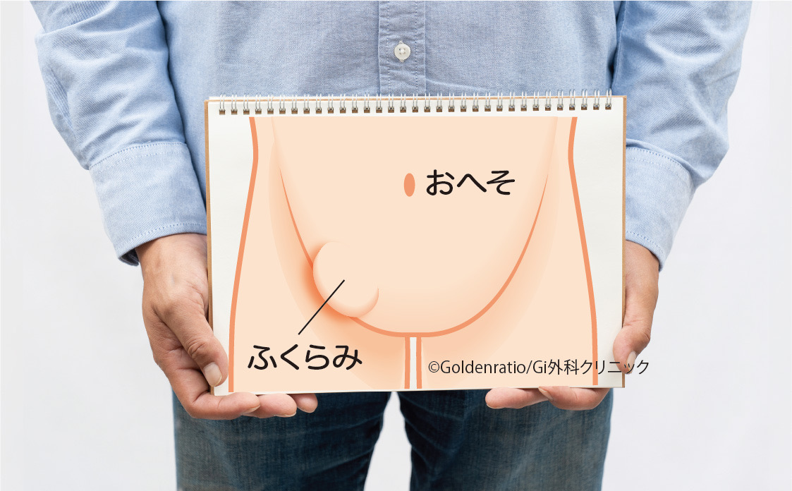 6月1日は「鼠径（そけい）ヘルニアの日」